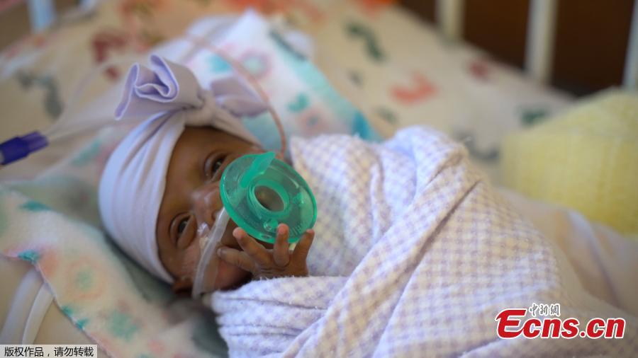The picture shows baby Saybie, the world\'s smallest surviving newborn, when she weighed 3 lbs in March 2019 in San Diego, California. A baby girl who weighed 245 grams and measured 23 cm became the smallest baby in the world, a US hospital reported after being discharged five months after being in intensive care. (Photo/Agencies)